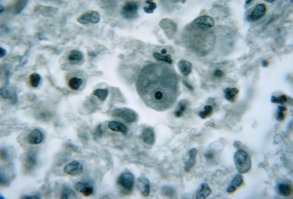 Brain-eating amoeba kills in the US: what it is and what it risks.  (Photo by Smith Collection / Gado / Getty Images).