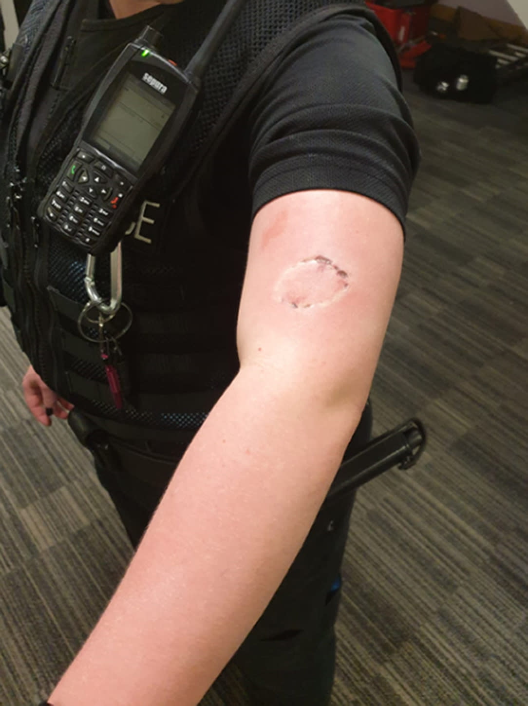 The female officer was left with a severe bite mark. (PA)