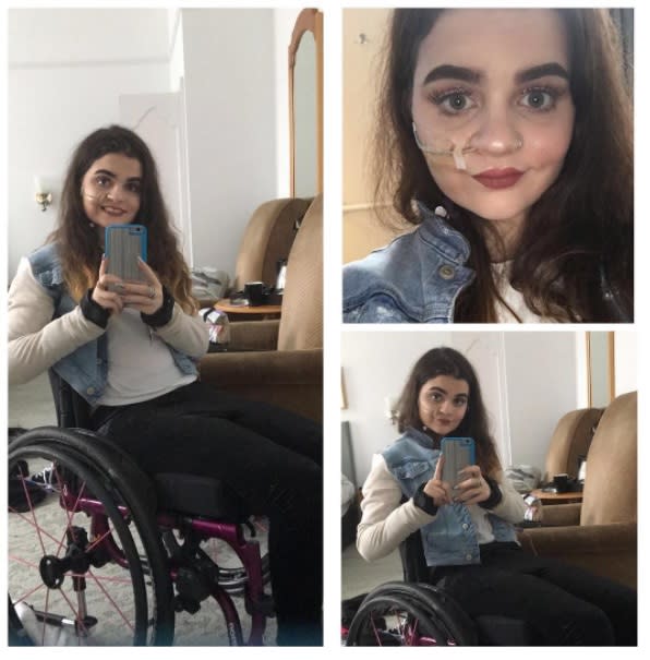 <p>La enfermedad le fue diagnosticada a los 17 años y, desde ese momento, Emily se alimenta a través de un tubo gástrico, ya que su cuerpo no funciona correctamente como para digerir la comida de manera adecuada. </p>