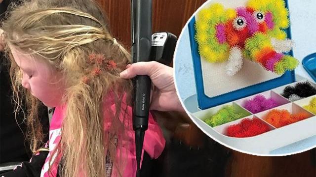 Popular Toy Bunchems Causing Hair-Raising Experiences for Parents, Kids -  ABC News