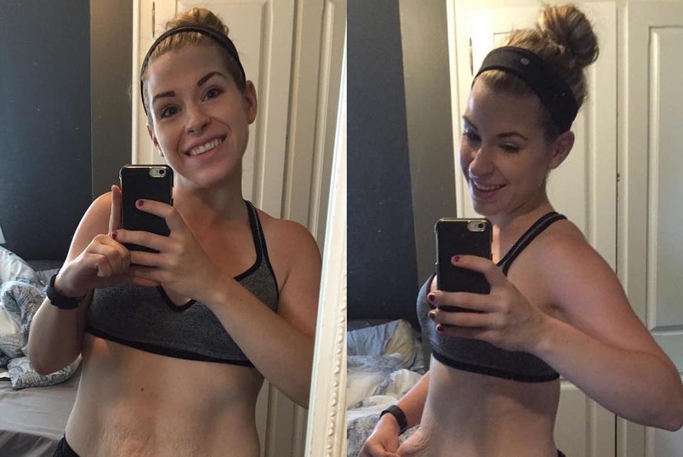 This woman shared her incredible weight loss journey with the world —excess skin and all