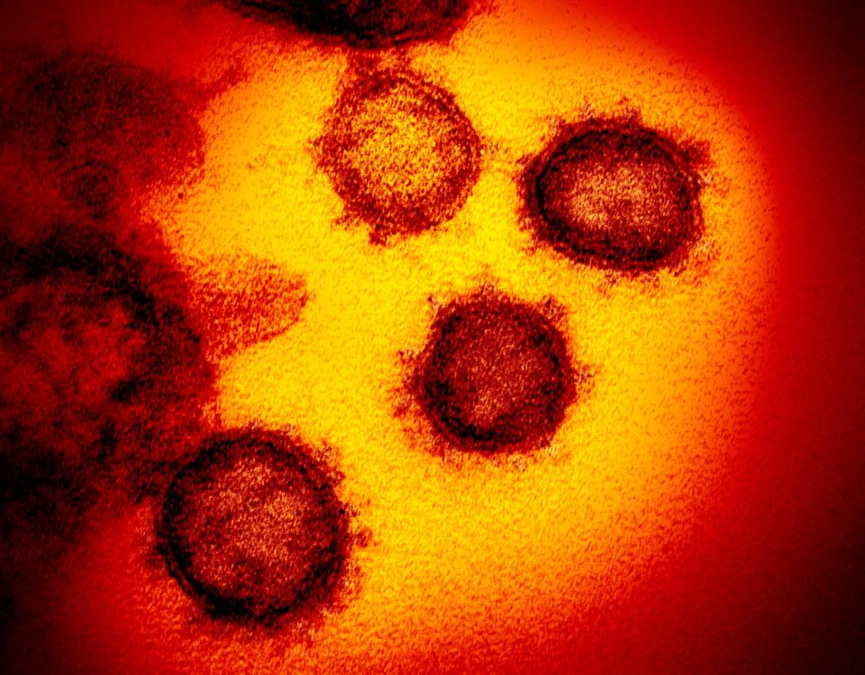 This undated electron microscope image made available by the U.S. National Institutes of Health at the start of the COVID-19 pandemic shows the Novel Coronavirus SARS-CoV-2. The sample was isolated from a patient in the U.S.