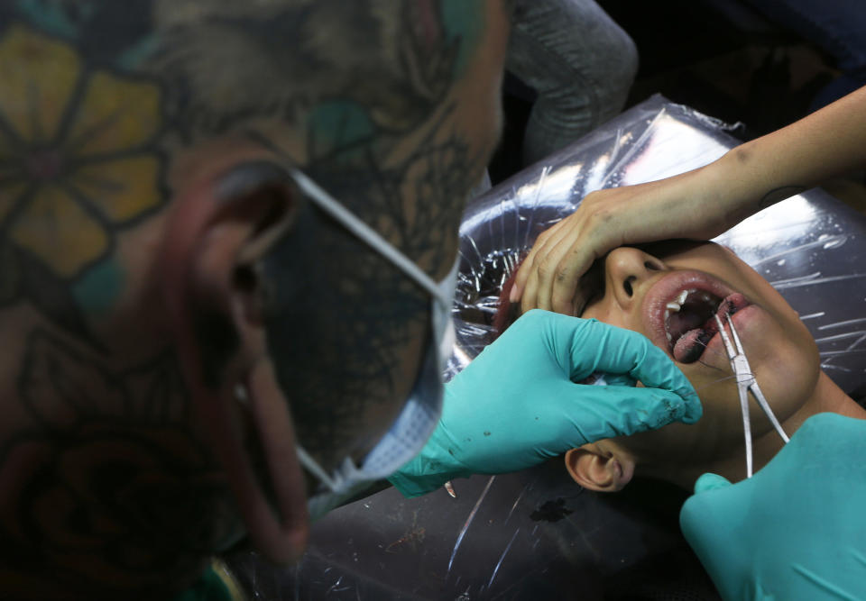 En esta foto del 18 de abril de 2019, Ariel Guzmán, también conocido como el artista del tatuaje Fakundo, realiza una modificación del cuerpo con la lengua dividida en un cliente en el salón de tatuajes Corona en la Ciudad de México. (AP Foto / Marco Ugarte)