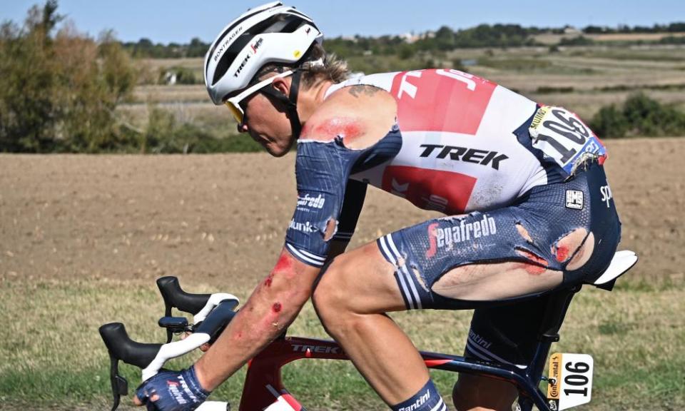 The Trek-Segafredo rider Toms Skujins was just one of numerous riders to crash heavily on a hectic stage 10 of the Tour de France.