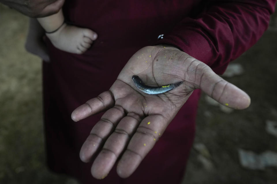 Aash Mohammed holds a fish which had slipped out of his asthmatic child's mouth who failed to swallow it, in Hyderabad, India, Saturday, June 8, 2024. Every year thousands of asthma patients arrive here to receive a fish therapy from the Bathini Goud family, which keeps a secret formula of herbs, handed down by generations only to family members. The herbs are inserted in the mouth of a live sardine, or murrel fish, and slipped into the patient's throat. (AP Photo/Mahesh Kumar A.)