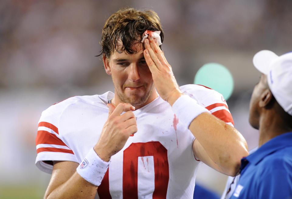 68654 Bergen, East Rutherford 8/16/2010 Giants quarterback Eli Manning holds a bloody cut on his forehead after geting hit during the second quarter of Monday's pre-season football game against the Jets at the New Meadowlands Stadium. TYSON TRISH/STAFF PHOTOGRAPHER