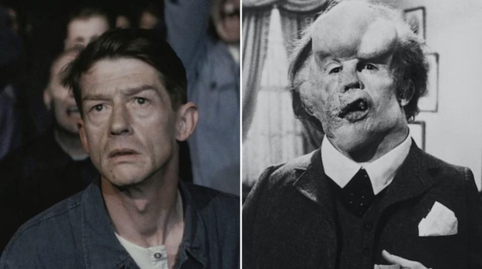 Actor John Hurt in “1984” (20th Century Fox) and ‘The Elephant Man” (Brooksfilms/Paramount Pictures)