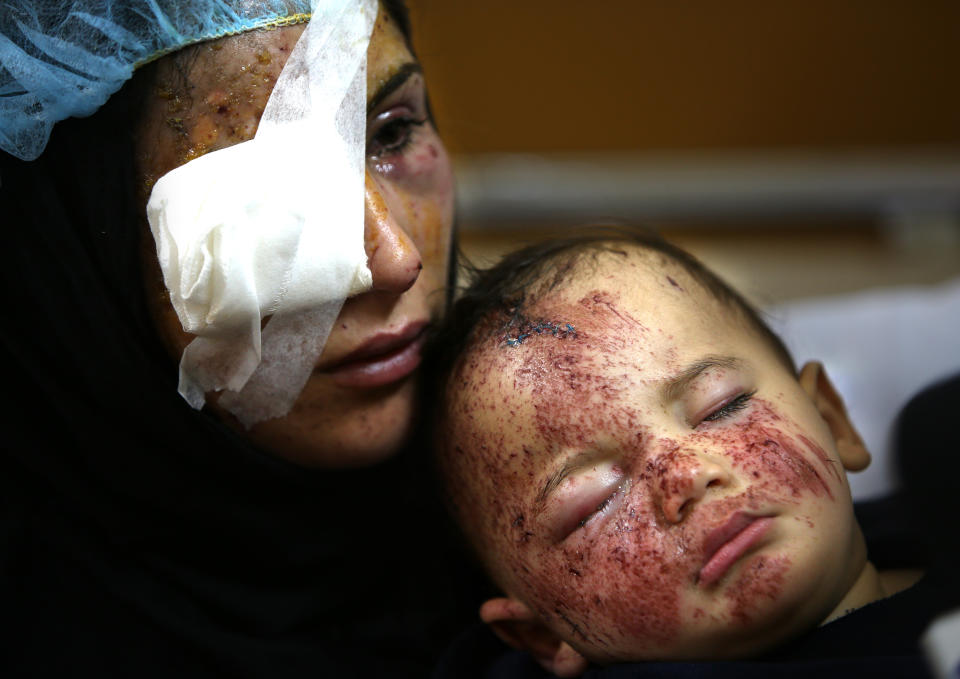 A Lebanese woman, Ghadeer Mortada, 18, who was wounded along with three members of her family, holds her one-year-old boy, Mohammed, in a hospital, after a deadly car bomb exploded Saturday evening, in the predominately Shiite town of Hermel, about 10 miles (16 kilometers) from the Syrian border in northeast Lebanon, Sunday, Feb. 2, 2014. A shadowy Lebanese Sunni extremist group late Saturday claimed responsibility for a suicide car bombing in Hermel, a stronghold of Lebanon's Shiite militant Hezbollah group, that killed several people in the latest attack linked to the war in neighboring Syria. (AP Photo/Hussein Malla)