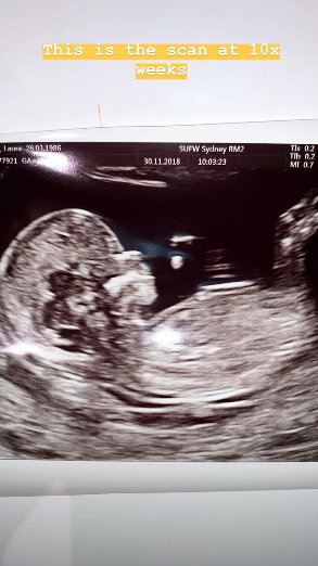 The couple proudly shared ultrasound photos and videos online. Photo: Instagram