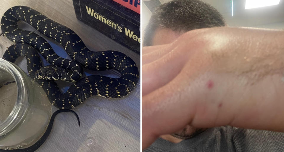 Left, the snake coiled up beside a jar and boardgames. Right, the man shows his swollen hand to camera with the red bite mark visible. 