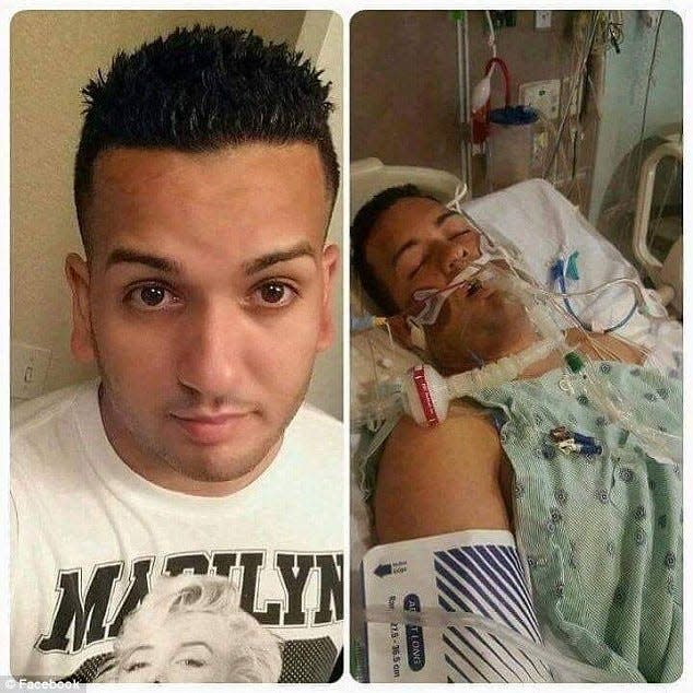 Tony Marrero was shot four times in the back with one bullet that also hit his arm at Pulse nightclub in Orlando, Fla. His recovery from the 2016 shooting was lengthy and his scars, he says, are proof of his strength and the resilience of the LGBTQ community.