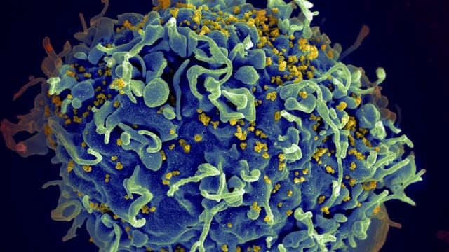 This colorized electron microscope image shows a human T cell.