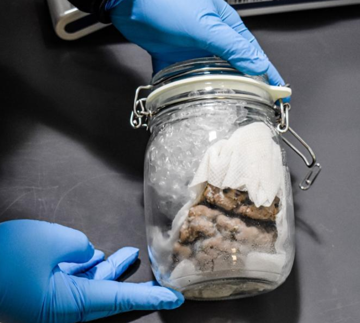 US Authorities seized a human brain in a mason jar. Source: CBP/Twitter