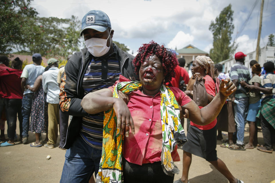 A woman who was injured after being trampled is helped away, after residents desperate for a planned distribution of food for those suffering under Kenya's coronavirus-related movement restrictions pushed through a gate and created a stampede, causing police to fire tear gas and leaving several injured, at a district office in the Kibera slum, or informal settlement, of Nairobi, Friday, April 10, 2020. (AP Photo/Brian Inganga)