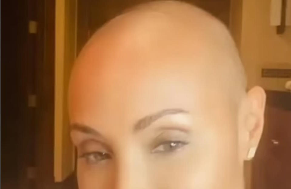 Jada Pinkett Smith has discussed her hair loss (c) Instagram credit:Bang Showbiz