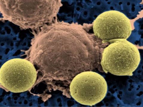 t-cells immune system cancer immunotherapy