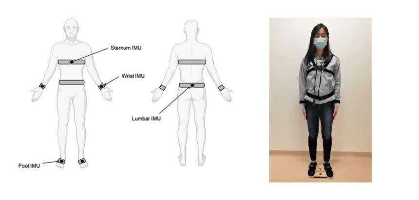 Tragbare Sensoren ermöglichen eine frühzeitige Erkennung des Fortschreitens der Parkinson-Krankheit.