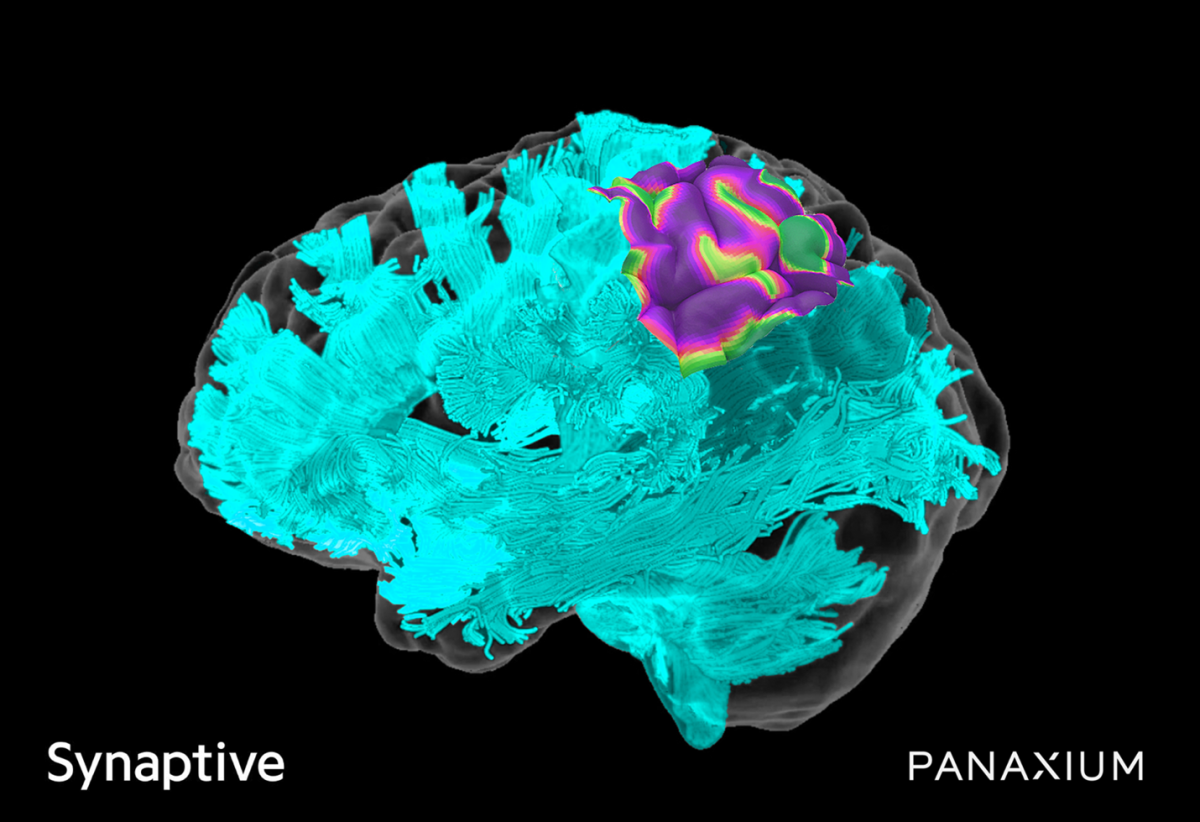 Synaptive Medical Partners with Panaxium to Bring Real-Time Intelligent High-Resolution Cortical Mapping to Neurosurgical OR