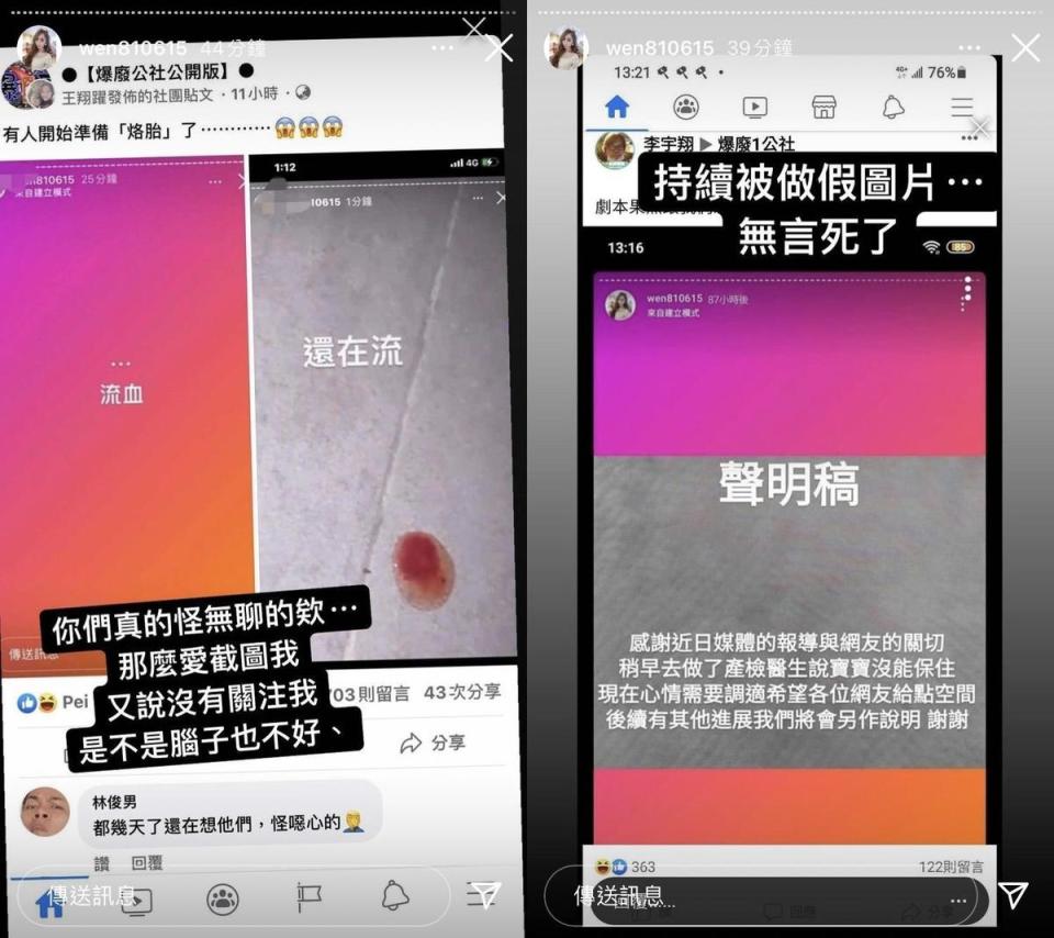 罔腰否認流產消息，表示是被做成假圖片。（翻攝自罔腰IG）