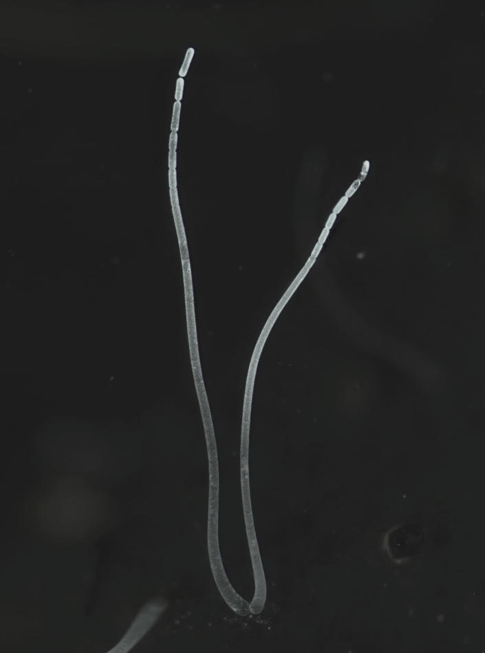 This microscope photo provided by the Lawrence Berkeley National Laboratory in June 2022 shows filaments of a Thiomargarita magnifica bacteria cell. The species was discovered among the mangroves of Guadeloupe archipelago in the French Caribbean. A team of researchers at the Department of Energy (DOE) Joint Genome Institute (JGI), Lawrence Berkeley National Laboratory (Berkeley Lab), the Laboratory for Research in Complex Systems (LRC), and the Université des Antilles, characterized the bacterium composed of a single cell that is 5,000 times larger than other bacteria. (Jean-Marie Volland/Lawrence Berkeley National Laboratory via AP)