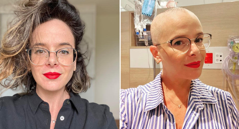 Na’ama with and without hair during her chemotherapy treatment.