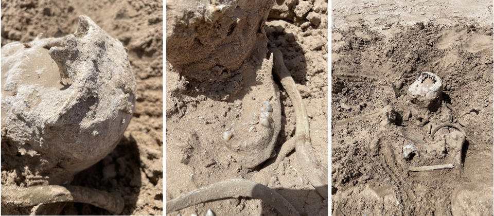 These photos of Saturday, May 7, 2022, provided by Lindsey Melvin of Henderson, Nev., shows human remains she and her sister discovered on a sandbar that recently surfaced as Lake Mead recedes. A closer look revealed a human jaw with teeth. The National Park Service confirmed in a statement that the bones are human. (Lindsey Melvin via AP)