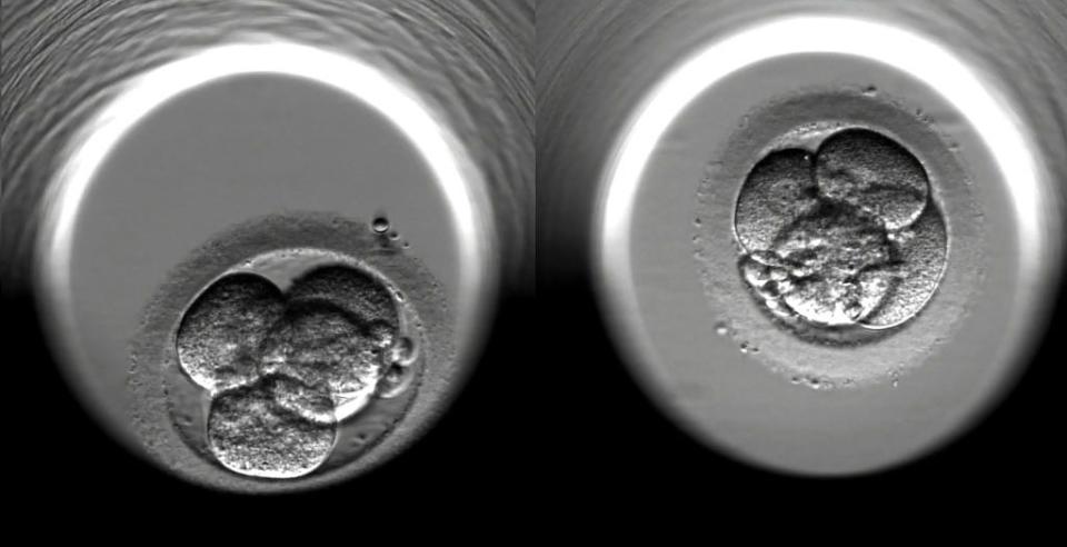 london 2016 this undated screen grab shows the cell division of two fertilized human embryos during the first 48 hours of embryonic development following ivf treatment at a private clinic in london the medical world is marking the 40th anniversary of ivf louise joy brown, the worlds first test tube baby, was born on july 25th, 1978 at royal oldham hospital since then an estimated five million babies have been born through assisted reproduction worldwide photo by jim dysongetty images