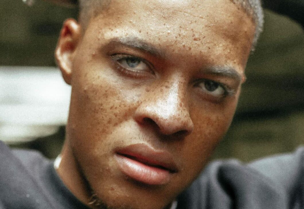 close-up of black man with freckles on his face