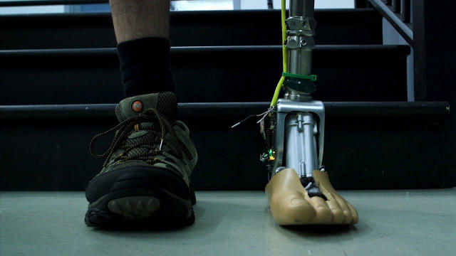 Smart prosthetic ankle can adapt to uneven ground