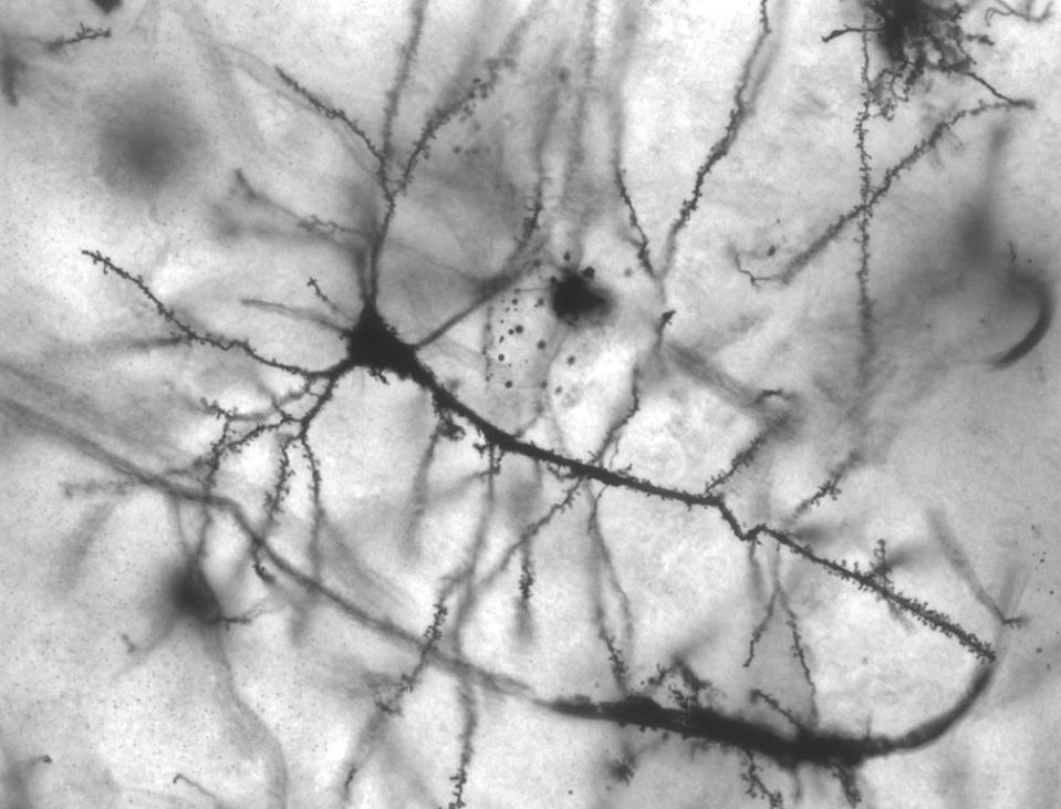 human neuron