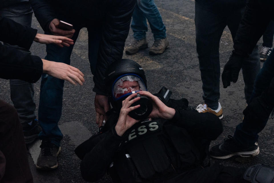 Au cours des heurts qui ont opposé samedi les manifestants aux forces de l'ordre, un journaliste indépendant qui couvrait l'évènement a malheureusement été très sévèrement blessé au visage par un tir de GLI F4 pendant l'acte 53 des Gilets jaunes. ©Samuel Boivin/NurPhoto via Getty Images