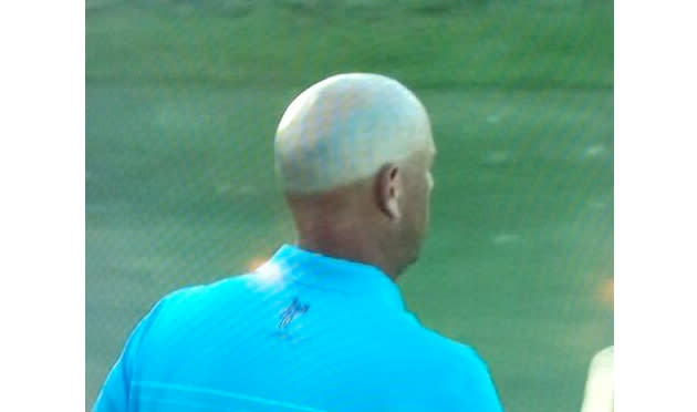 Stewart Cink has the worst tan you'll see