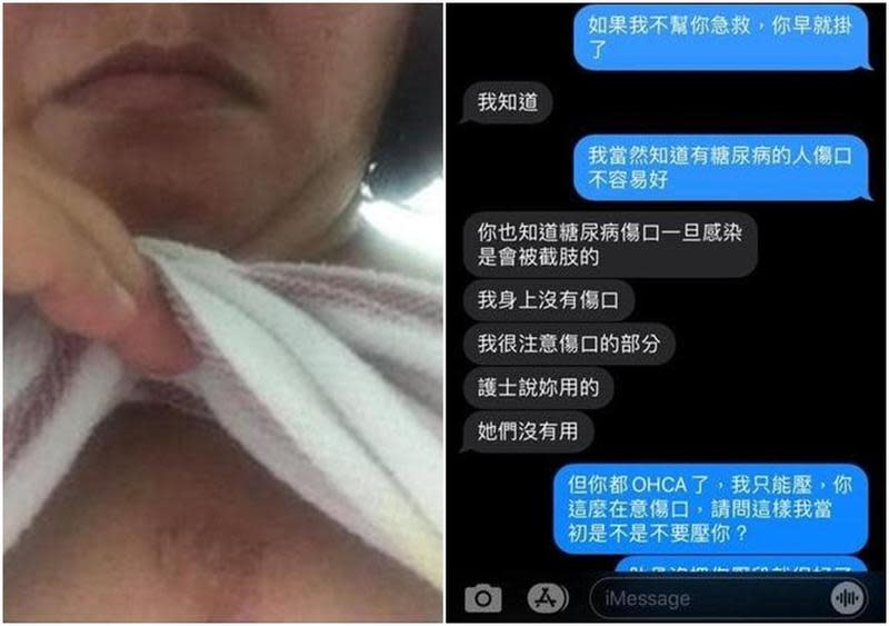 一名女網友在同事倒下後，在沒有AED的狀況下徒手狂壓救回同事，沒想到同事被救活後卻反控她「弄傷自己」嗆告。（翻攝自爆料公社）