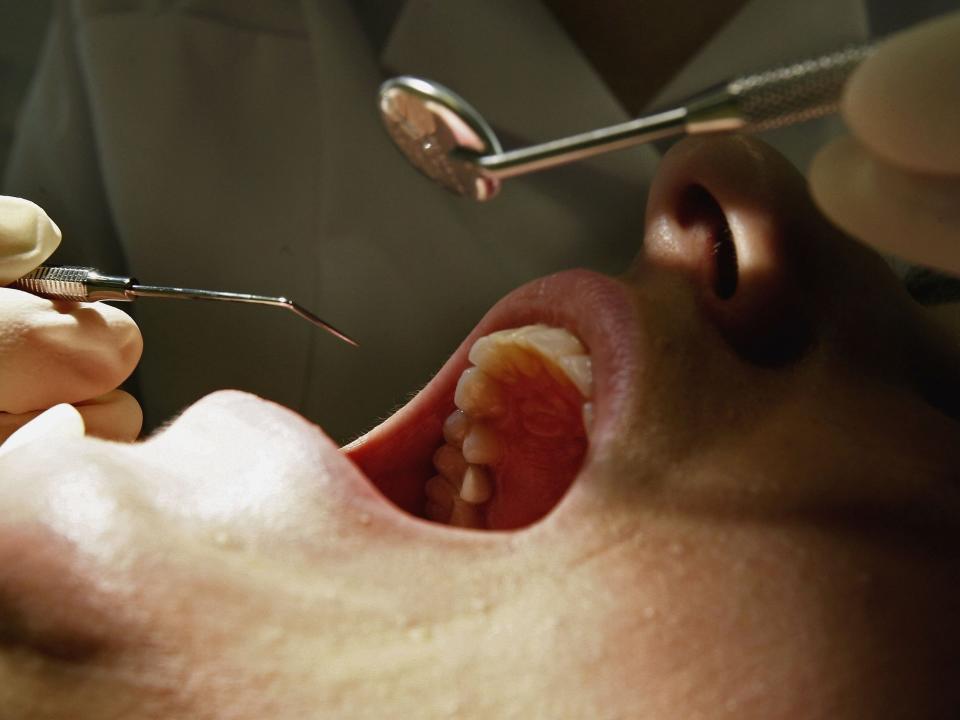 Teeth dentist