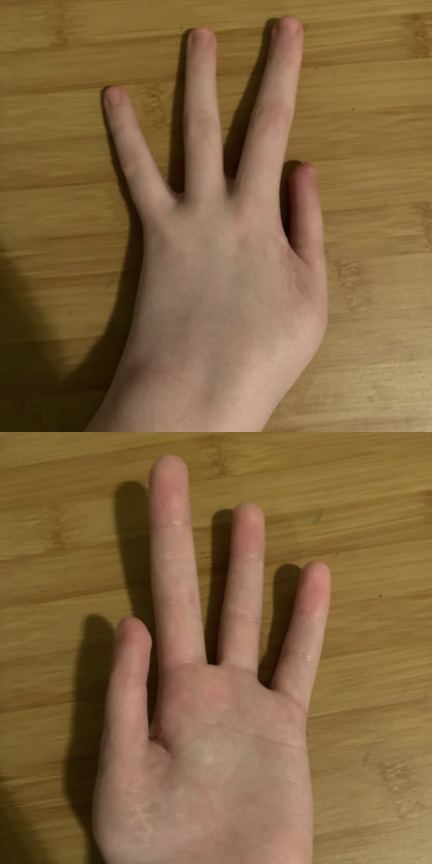 Two images of a left hand on a wooden surface. The top image shows the back of the hand, and the bottom image shows the palm of the hand