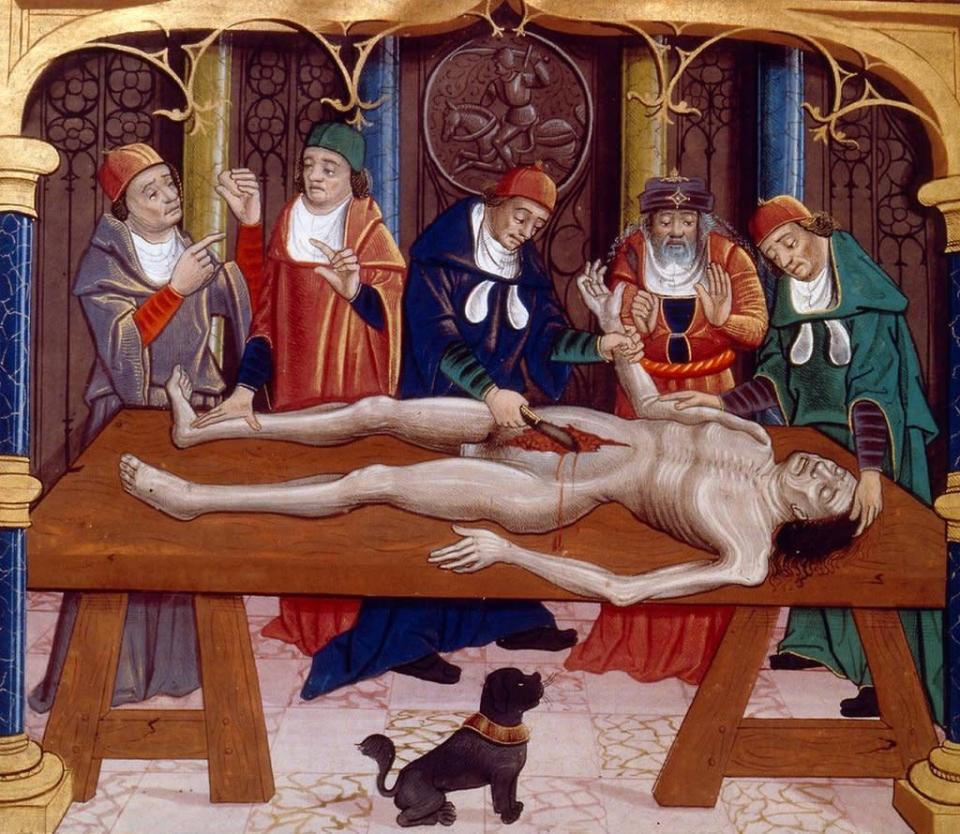 Ilustraci&#xf3;n medieval de una autopsia realizada en la edad media. Del manuscrito franc&#xe9;s &quot;Las propiedades de las cosas&quot; de Bartholomaeus Anglicus, finales del siglo XV.