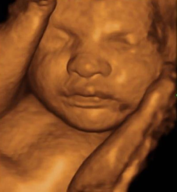 Babies could recognise faces in the womb new research has revealed [Photo: PA Images]