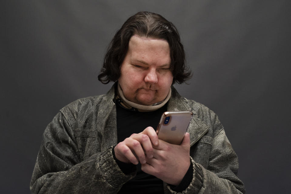 Joe DiMeo uses his cellphone while posing for a portrait, Monday, Jan. 25, 2021, in New York, six months after an extremely rare double hand and face transplant. Almost six months after a rare face and hands transplant, Joe DiMeo is relearning how to smile, blink, pinch and squeeze. The 22-year-old New Jersey resident had the operation last August, two years after being badly burned in a car crash.(AP Photo/Mark Lennihan)