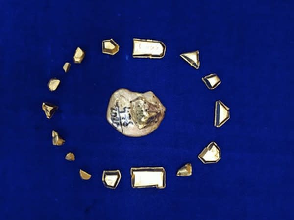 The gold seized by the Chennai Customs. 