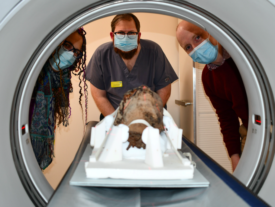 X-rays of the head were undertaken at Canterbury Christ Church University. (SWNS)