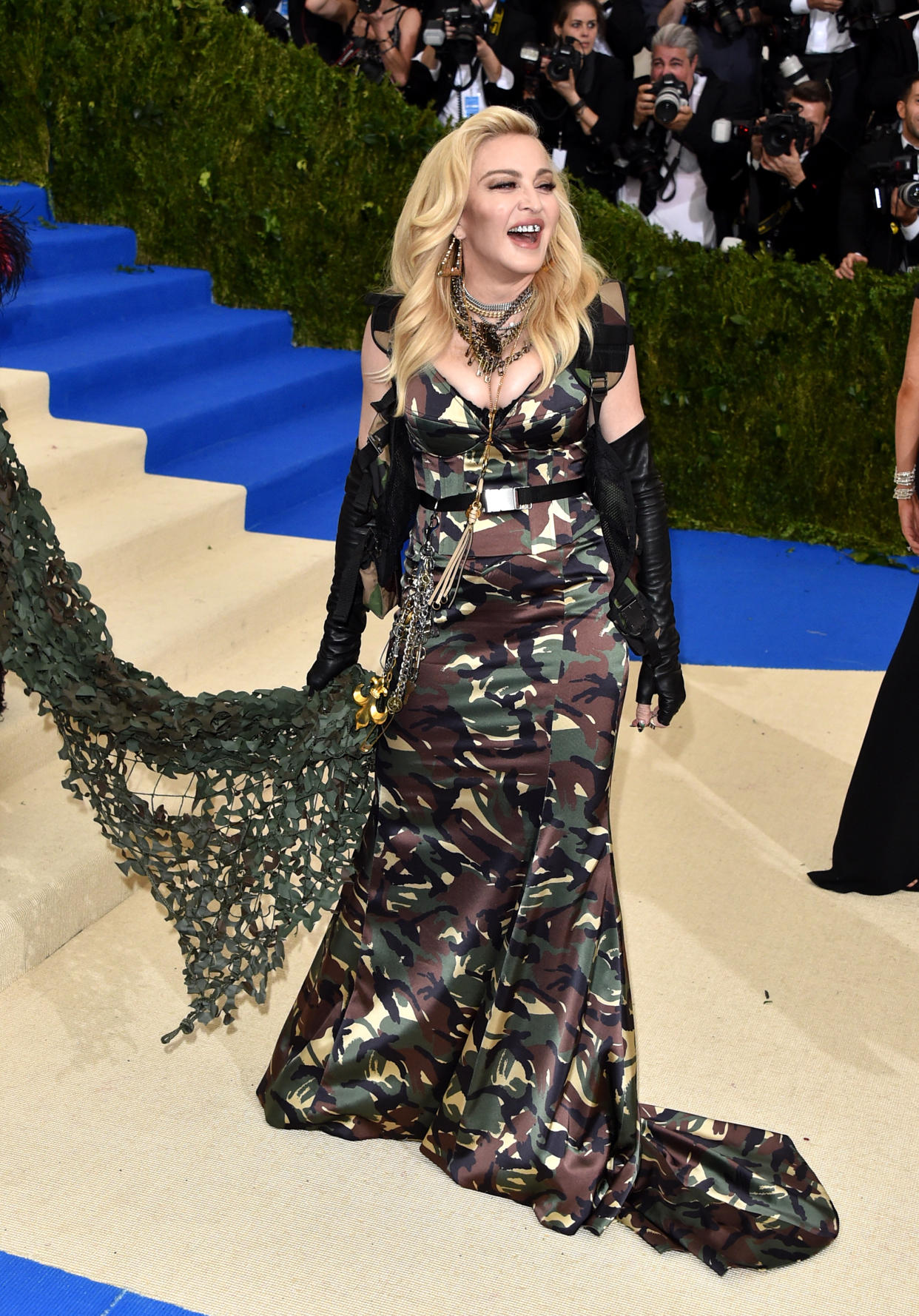 Madonna shows off bruise while wearing Versace (Photo by John Shearer/Getty Images)