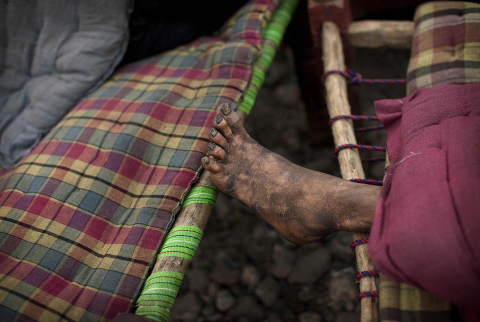 In this photo taken on Feb. 22, 2012, the worn foot of an Indian squatter is seen on a rented cot at Park No. 2 near Jama Masjid in New Delhi, India, early in the morning. For thousands of people struggling at the bottom of India's working class, the Meena Bazaar parking lot and the handful of places like it scattered across New Delhi are cheap refuges in a city where many migrants can't even afford to rent slum shanties. (AP Photo/Kevin Frayer)