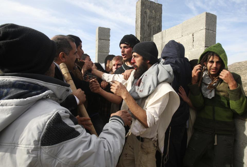 Injured Jewish settlers stand next to Palestinian villagers after being detained near Nablus