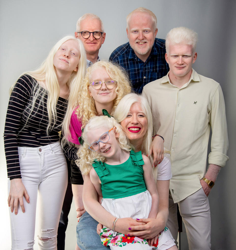 Albinos, blanco de prejuicios