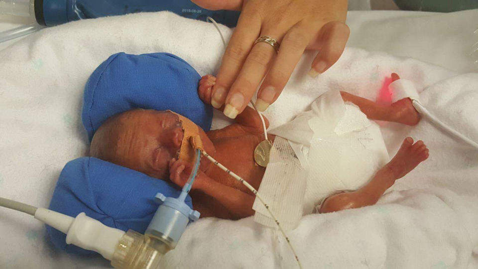 Lia Calzuola was told her son would not survive his first 48 hours. Source: Supplied