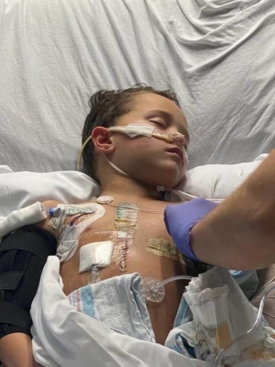 Jacob Estrada, de siete años, permaneció en la unidad de cuidados intensivos del hospital infantil Joe DiMaggio 52 días después del accidente.