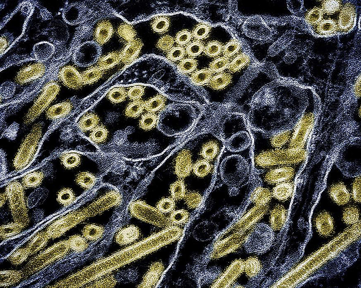 a colorized transmission electron micrograph of H5N1 virus particles grown in a lab. (CDC/NIAID via The New York Times)