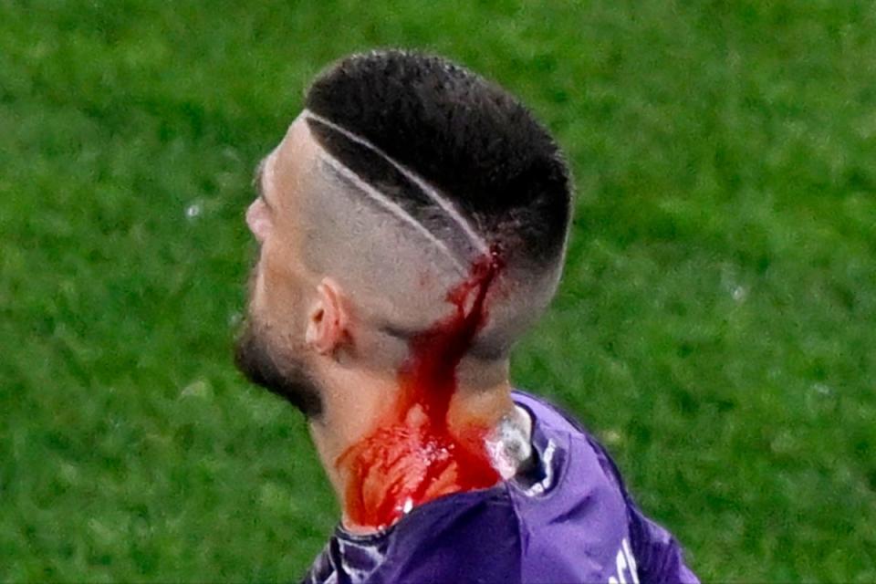 Fiorentina's Cristiano Biraghi was hit by an object thrown from the crowd (REUTERS)