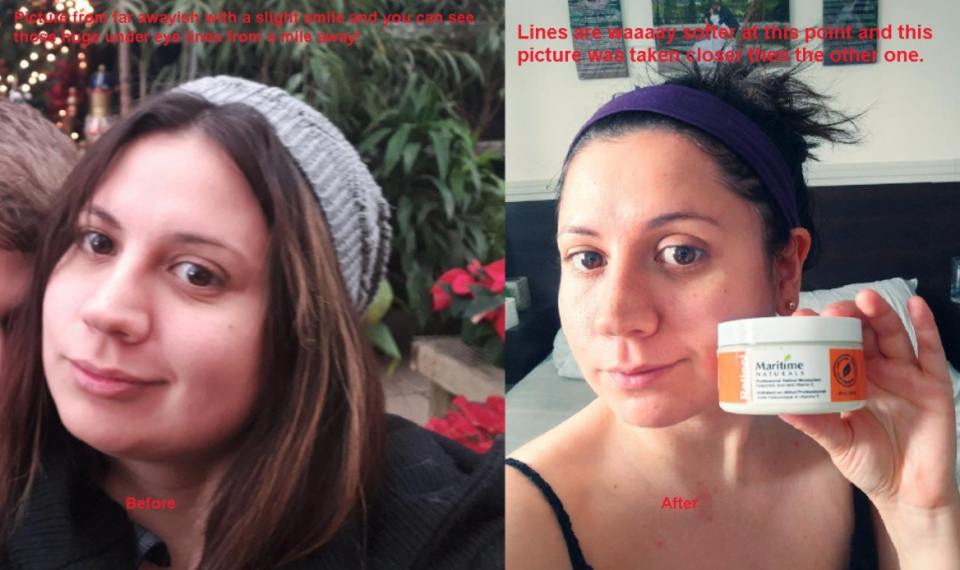 woman's before and after photos after using Maritime Naturals Professional Retinol Moisturiser 