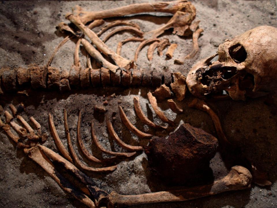 An aged skeleton is seen with a large block of rusted iron in the chest area